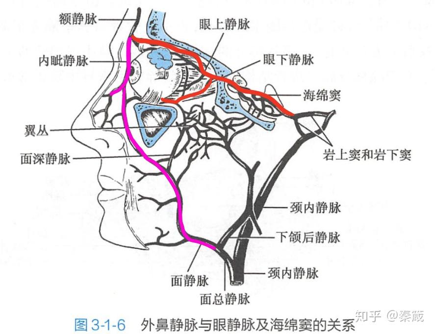 形区称为危险三角区鼻部皮肤可因为感染,病菌从内眦静脉逆流而上