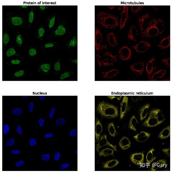 kaggle Human Protein Atlas 比赛总结 知乎