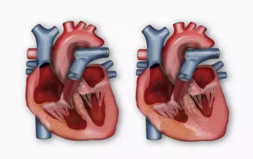 心脏病有多少种类_心脏病有哪些_心脏病有后天形成的吗