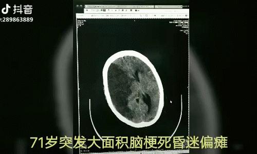 v2-a2cc4c712f5f74119bfb28cc5836d490_r.jpg