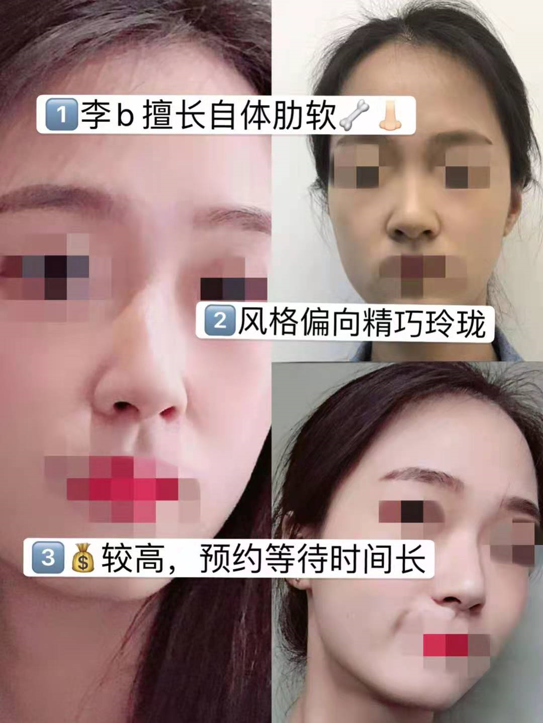 上海九院隆鼻哪个医生能做出妈生鼻？假体隆鼻&自软骨隆鼻 - 知乎