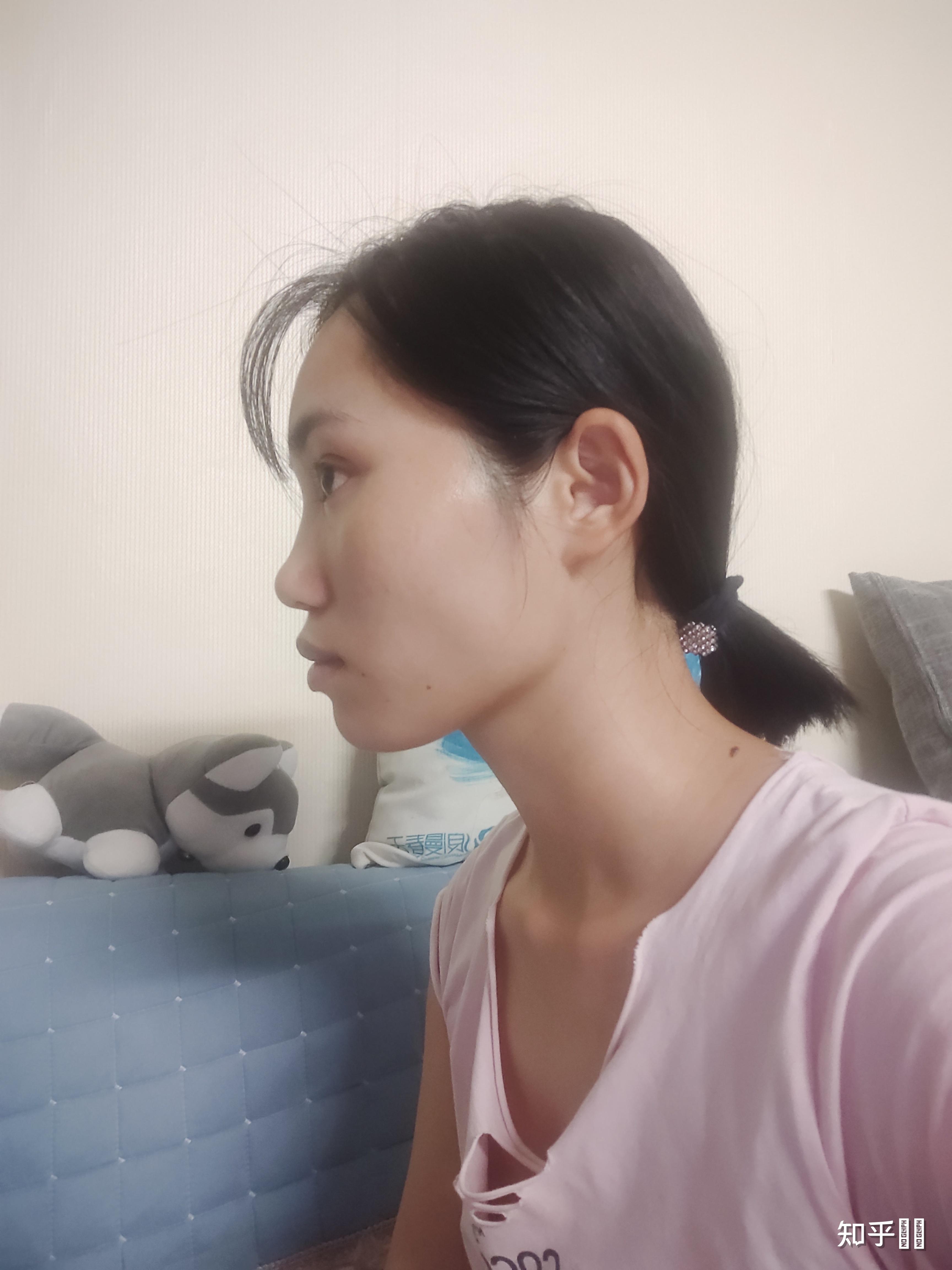 正脸好看但侧脸丑到爆是种怎样的体验? - 知乎