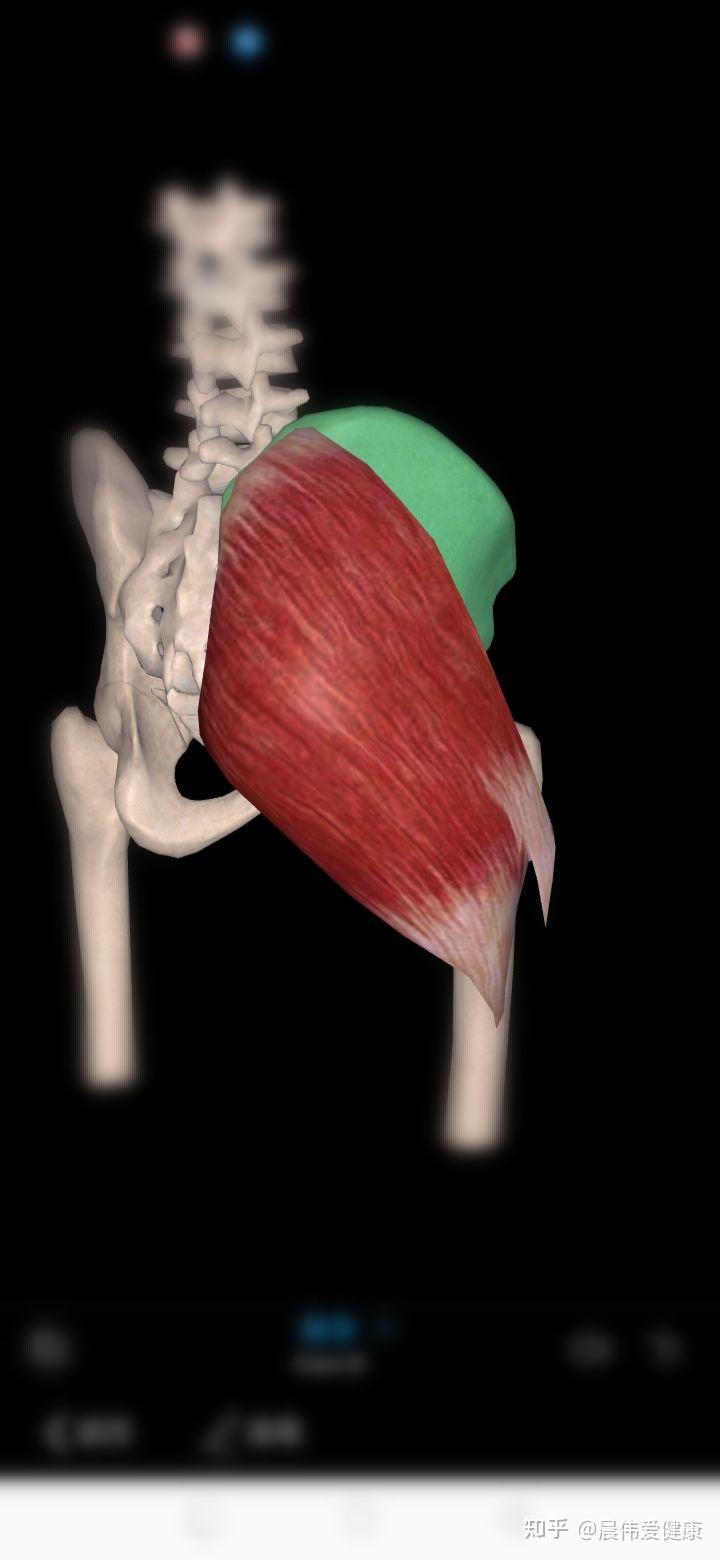 被压迫受伤的臀大肌