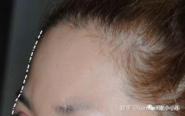 实操案例 禁得起折腾的脸都有个好看又自然眉骨 知乎