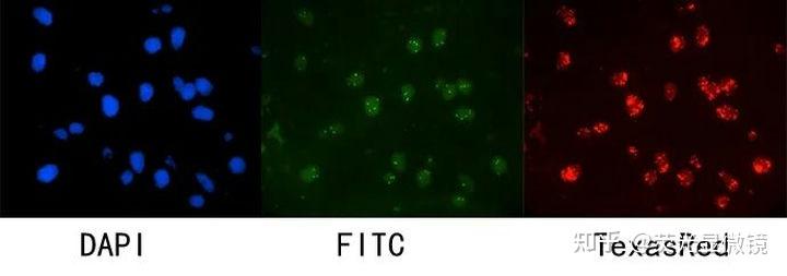 荧光显微镜与FISH荧光原位杂交技术 - 知乎