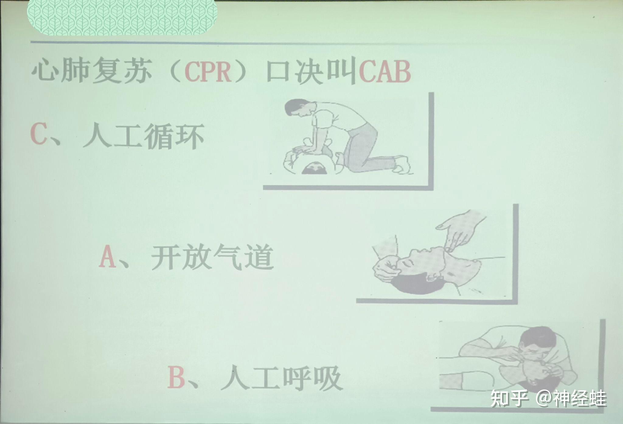 家庭常见急救技术 1.生命体征的评估 2.心肺复苏CPR: 3.创伤急救 4.烧伤 5.老年人常见急救技术 6.中毒的急救技术 - 知乎