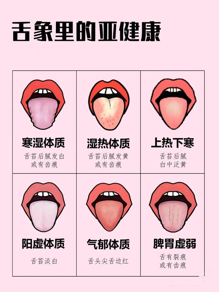 如何做养生达人？学中医养生知识，观察舌像里的亚健康 - 知乎