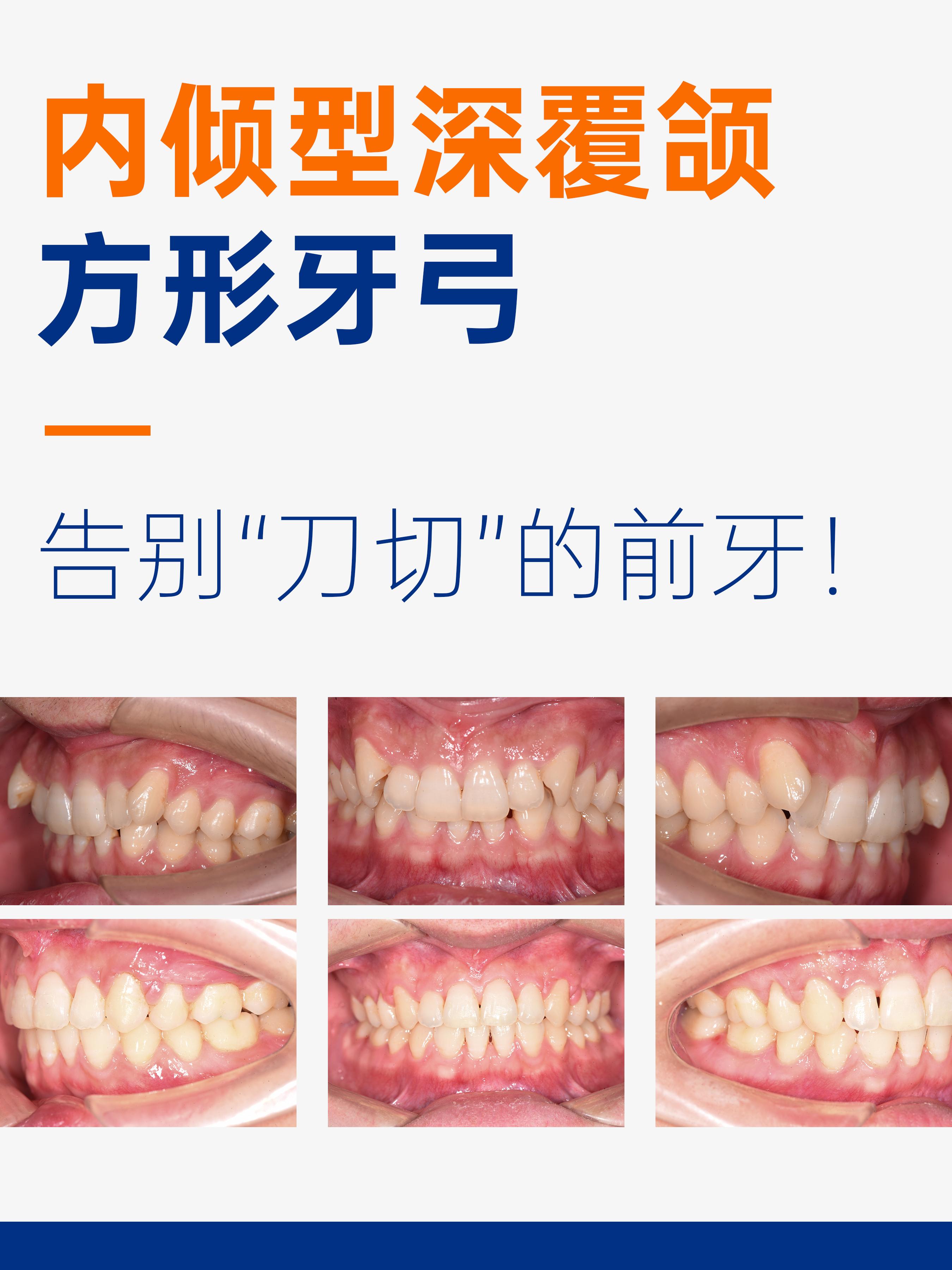 请问大家上海哪家医院矫正牙齿比较好？ - 知乎