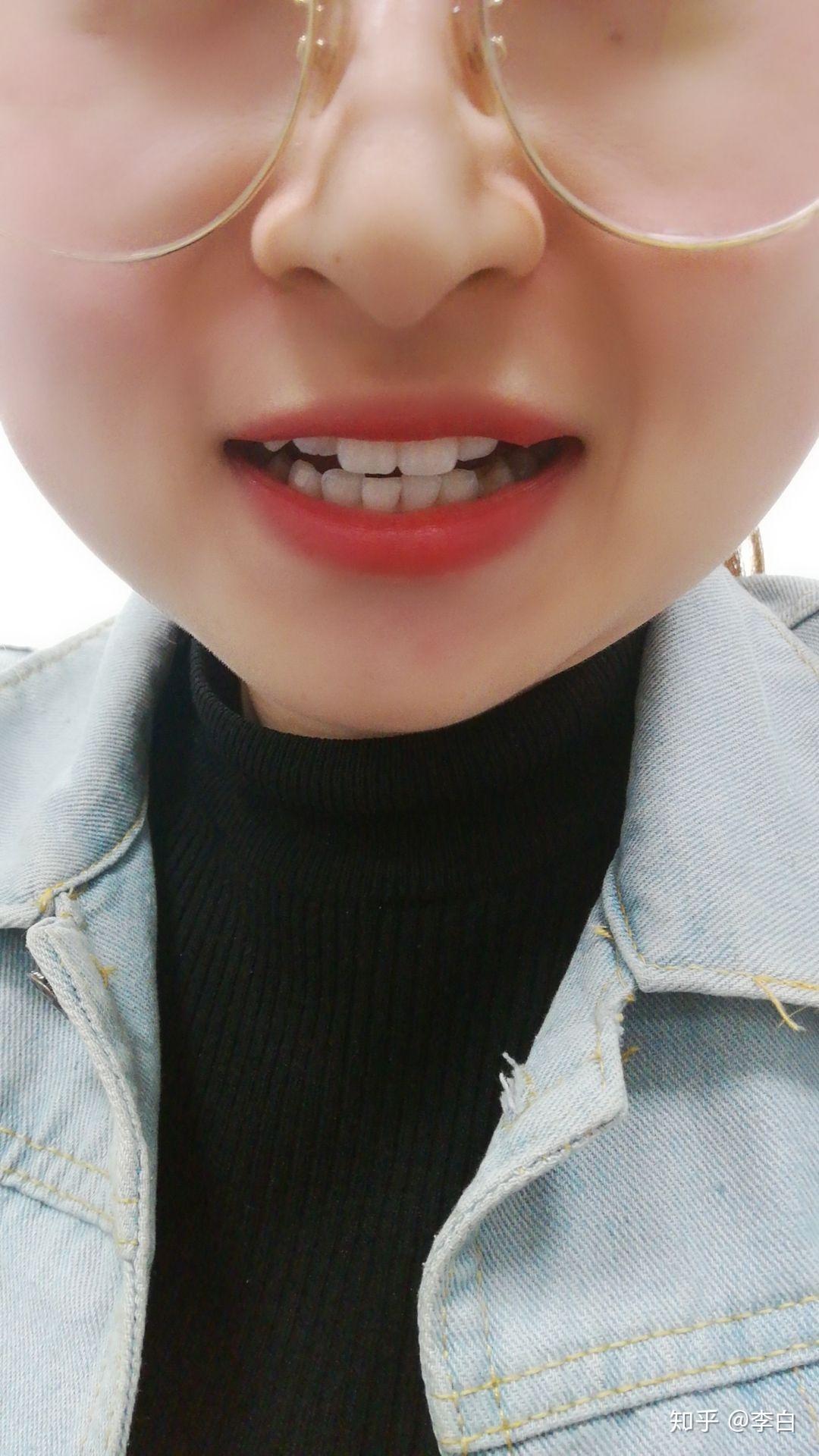 嘴巴太小是怎样的体验? - 知乎