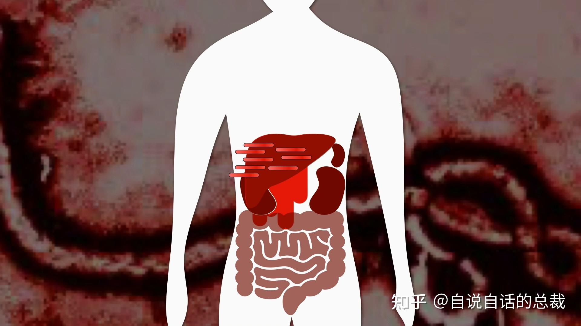 埃博拉病毒吐内脏图片图片