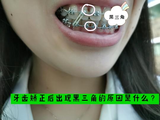v2-a38df4a4e1cfb61179378ecea9e35df4_1440w.jpg?source=172ae18b