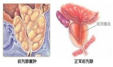 v2-a3a4300b6325720cc51985278315a001_1440w.jpg?source=172ae18b