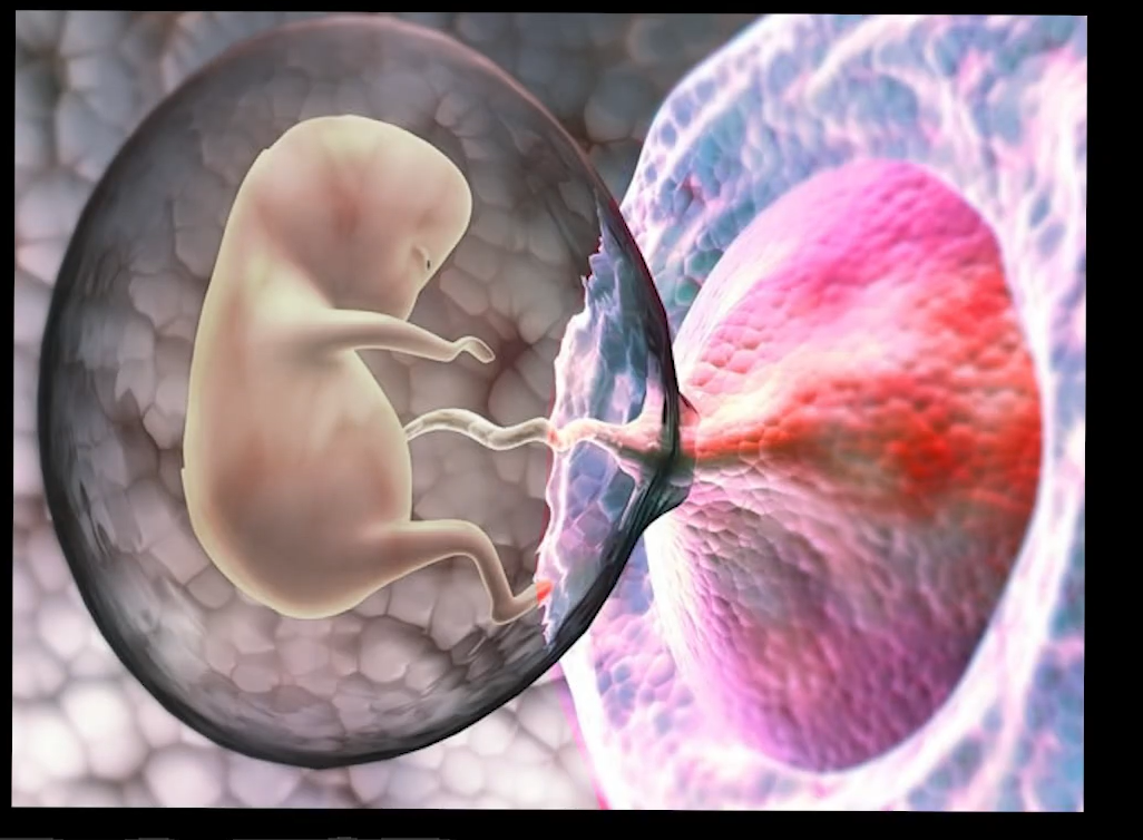 到其他部位(如输卵管宫外孕)她就会像癌细胞一样毫无节制地掠取营养