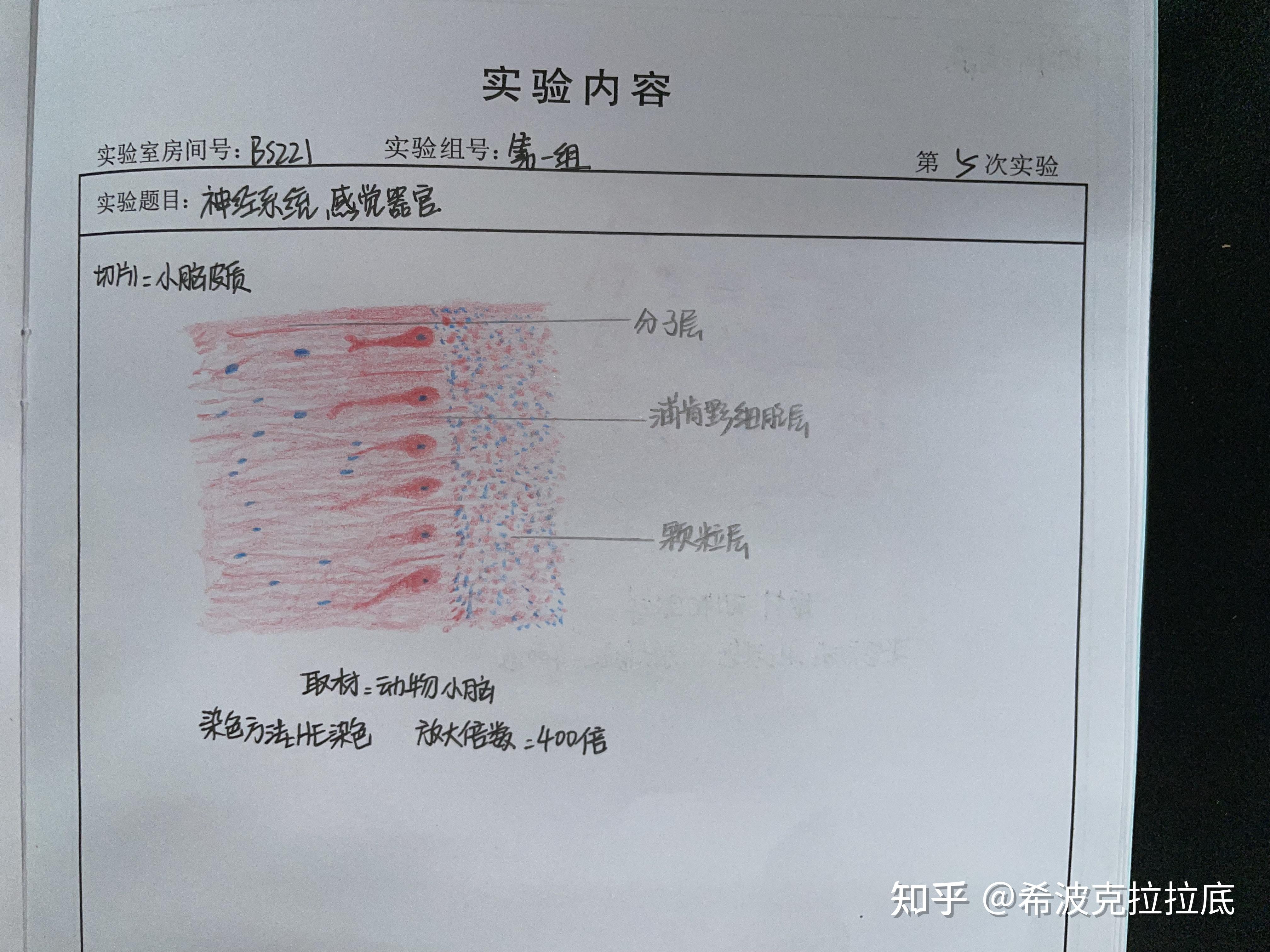 小脑皮质角膜视网膜内耳螺旋体