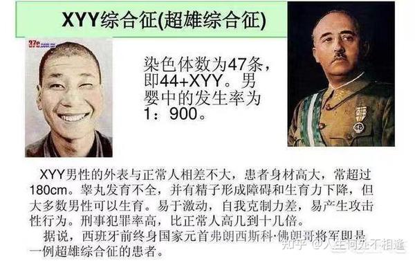 常见的性染色体非整倍体异常类型!超雄综合症 - 知乎