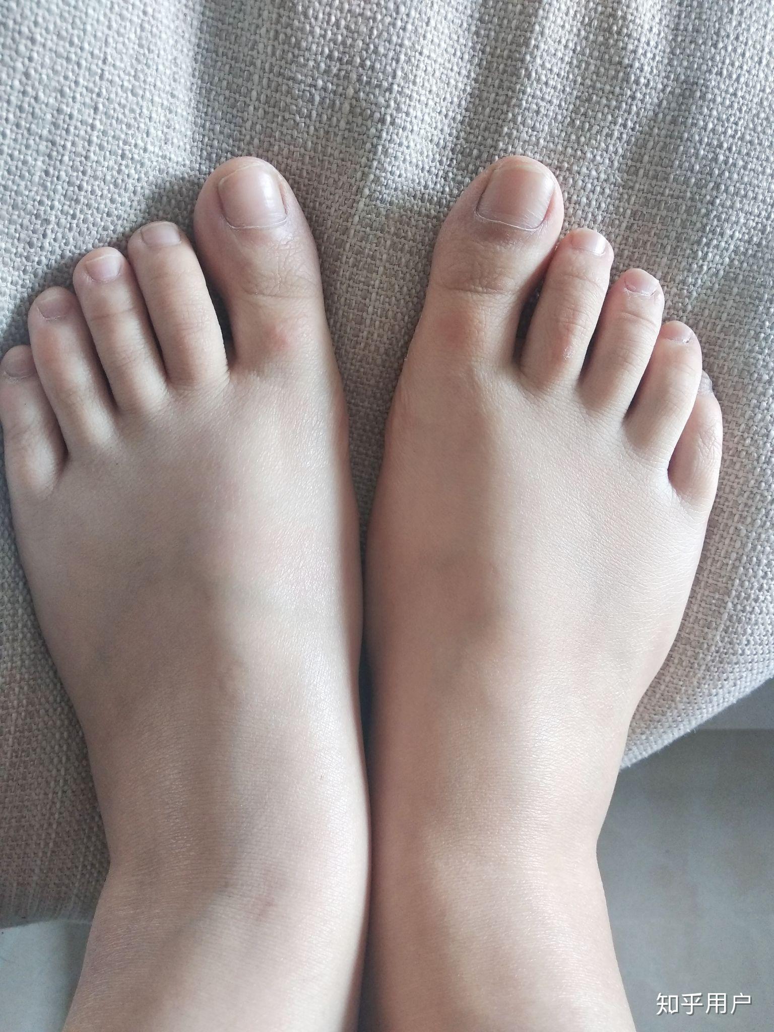 女生脚丑是种什么样的体验? - 知乎