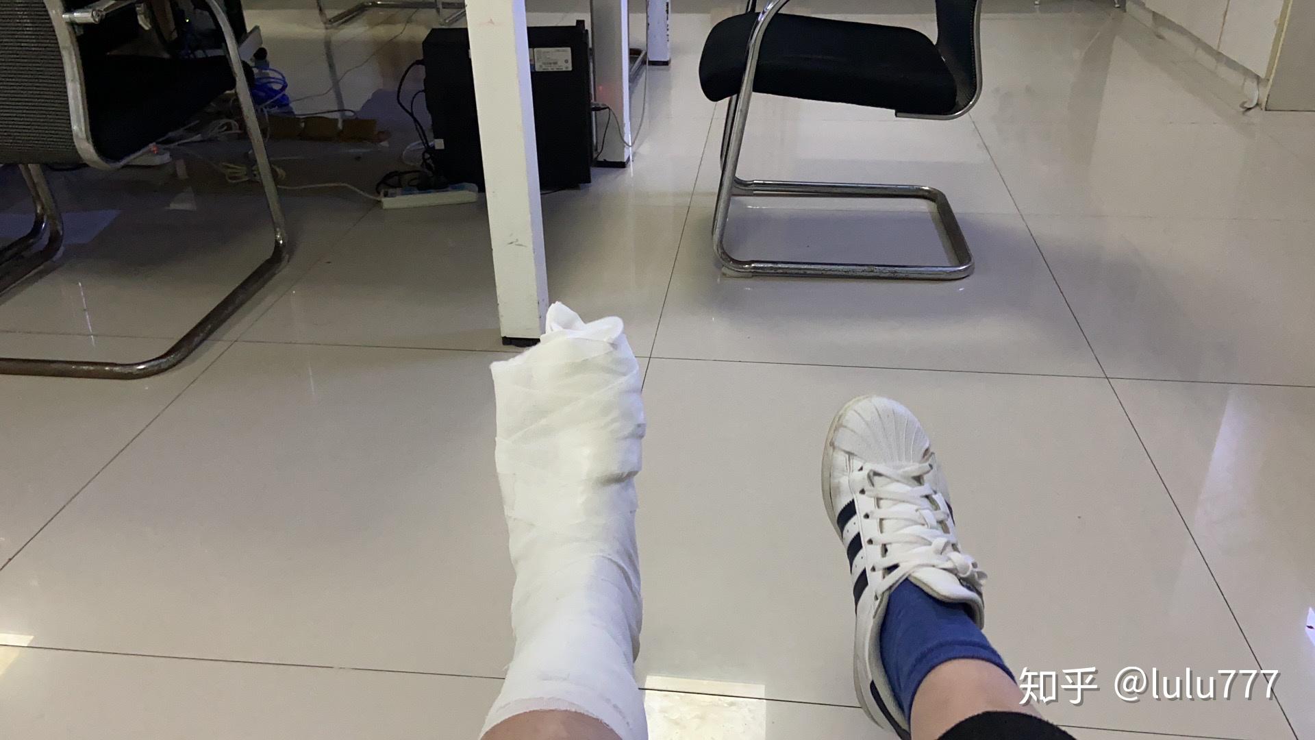 大拇脚趾头骨折 如何快速恢复? - 知乎