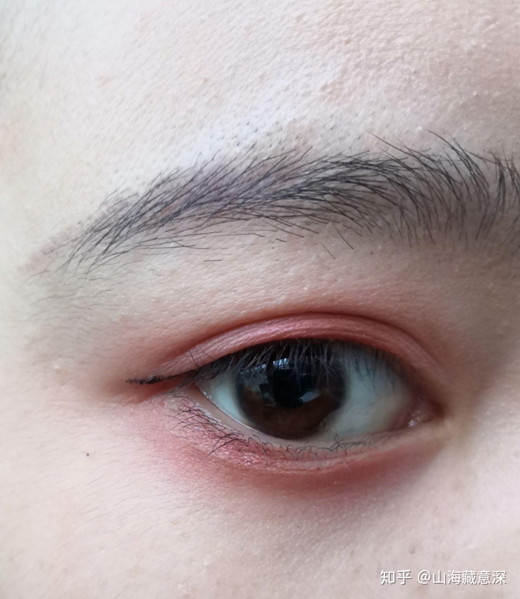 为什么我的眼白会是蓝色,天生就是这样? - 知乎