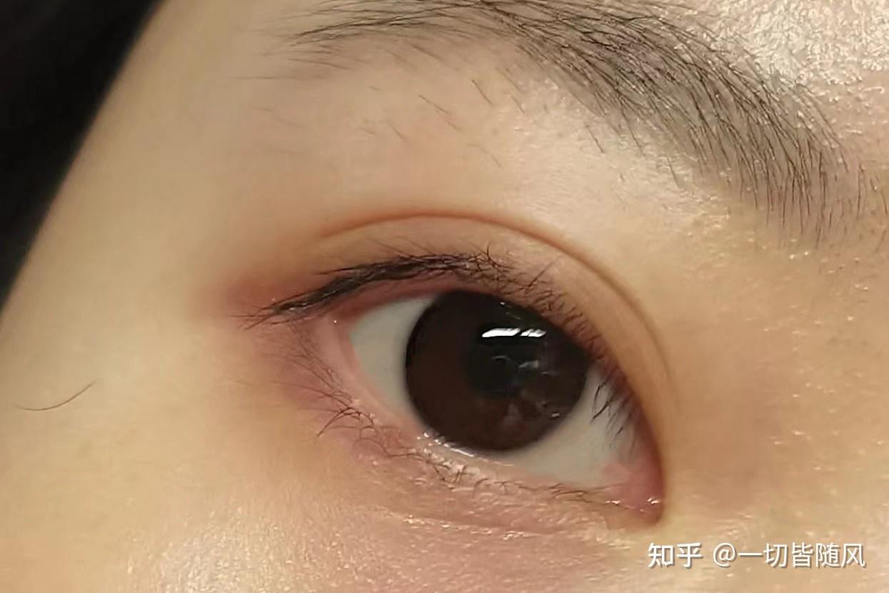 分享,从根源解决眼睛劳累损伤问题我坚持了一个月让原本红血丝遍布