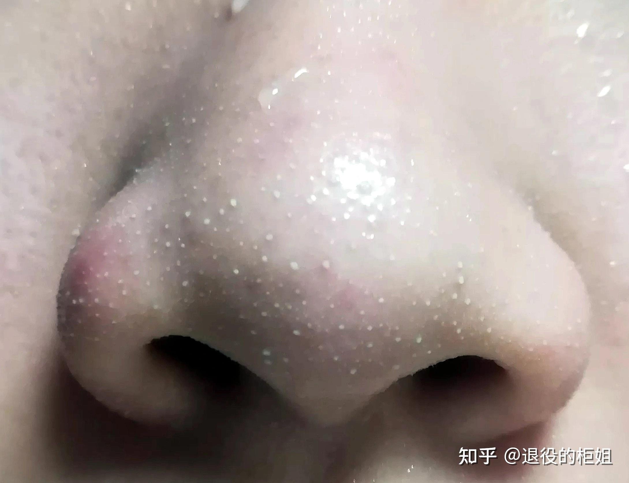 真的没有去草莓鼻的办法吗