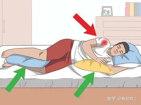 肩周炎如何专业康复建议收藏