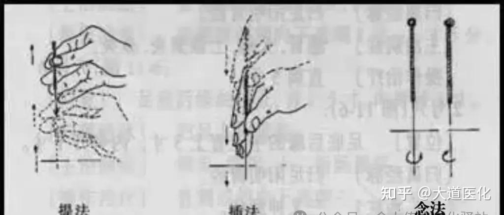 针灸入门手法必学! - 知乎