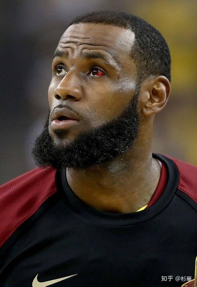 如何看待格林戳詹姆斯眼睛?