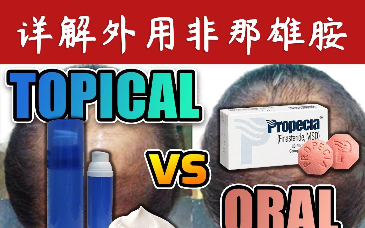 mann两年前谈防脱洗发水骗局 (非那雄胺米诺地尔) - 知乎