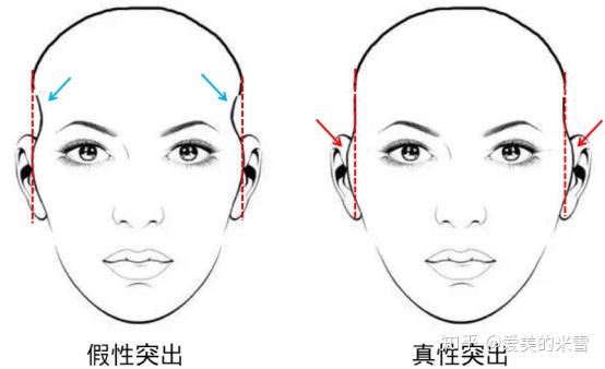 什么方法可以改善颧骨突出 v2-a4bed3de0ea83d2746f5b15cad45bac0_r.jpg