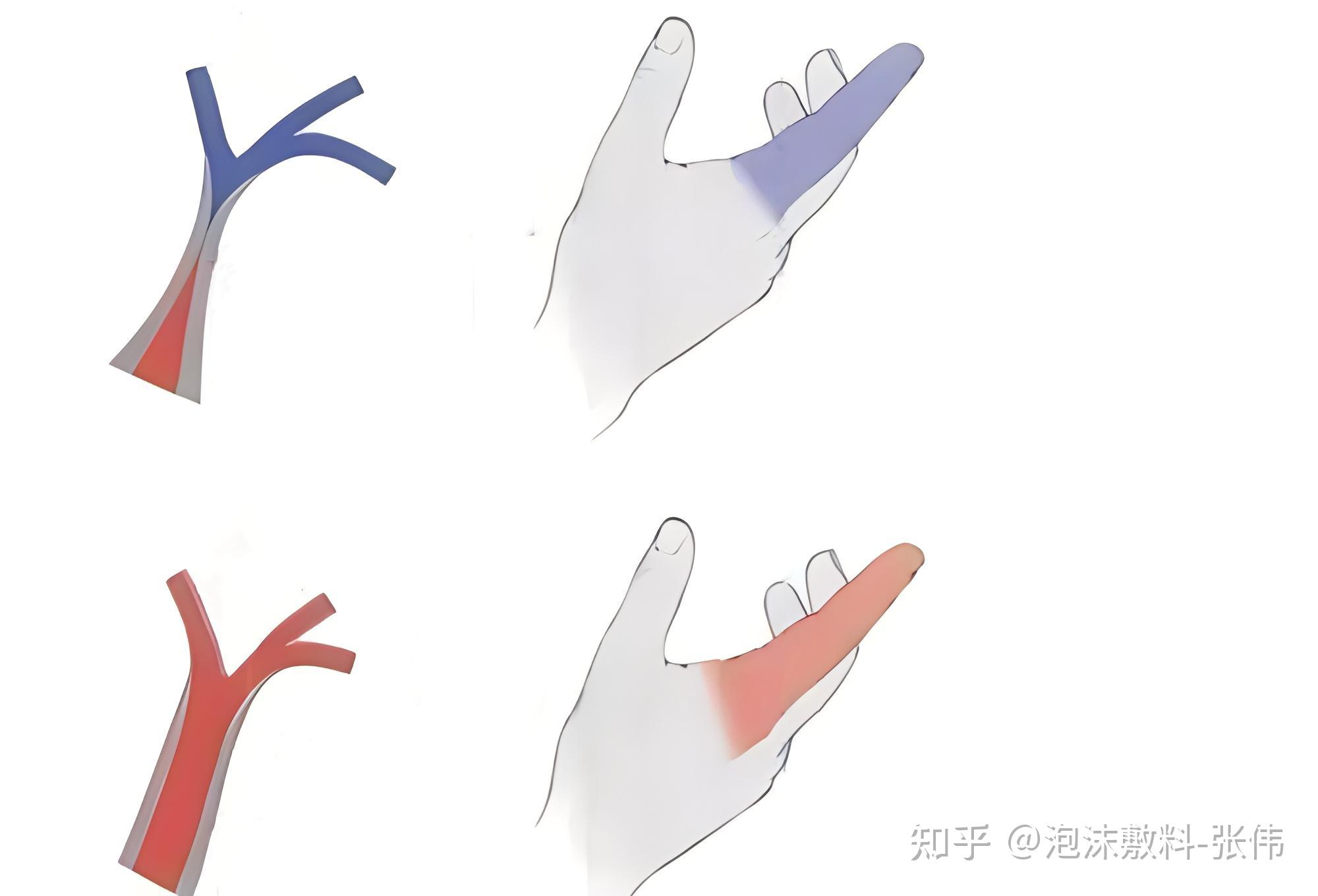 血流灌注的定义是什么,如何测量? - 知乎
