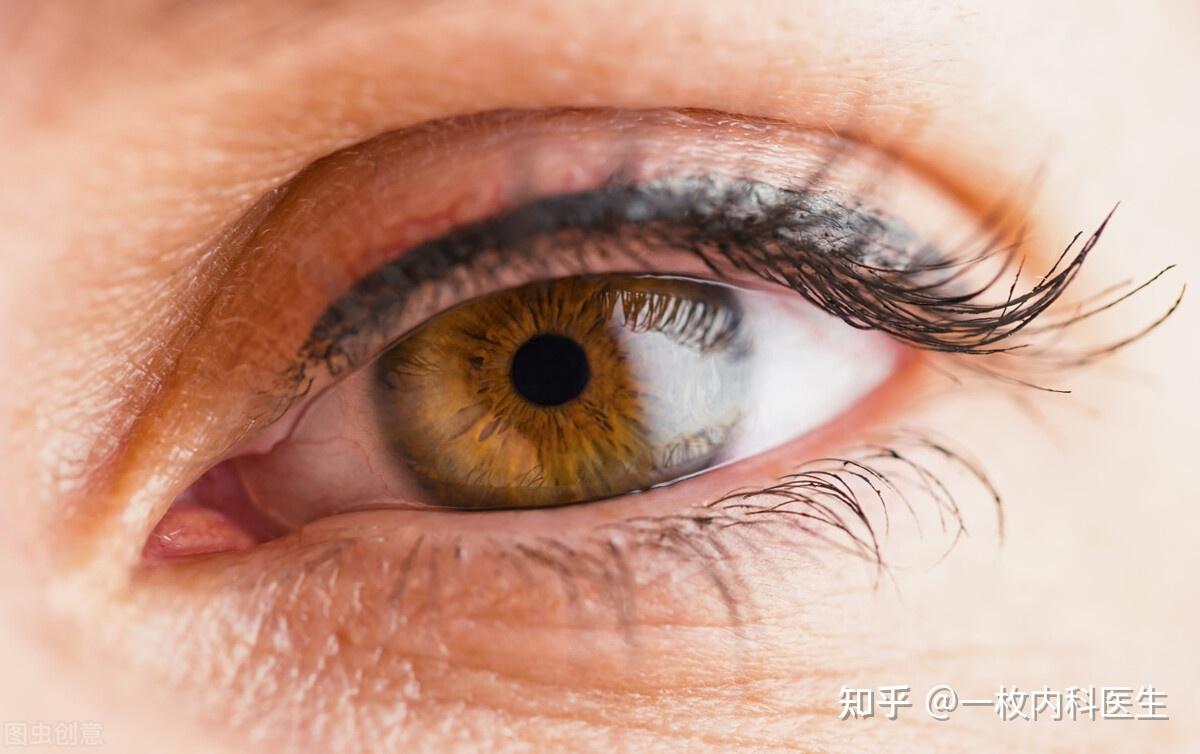 常见的问题就是葡萄膜炎,患者会出现眼睛酸痛,发红,实力出现下降,眼前