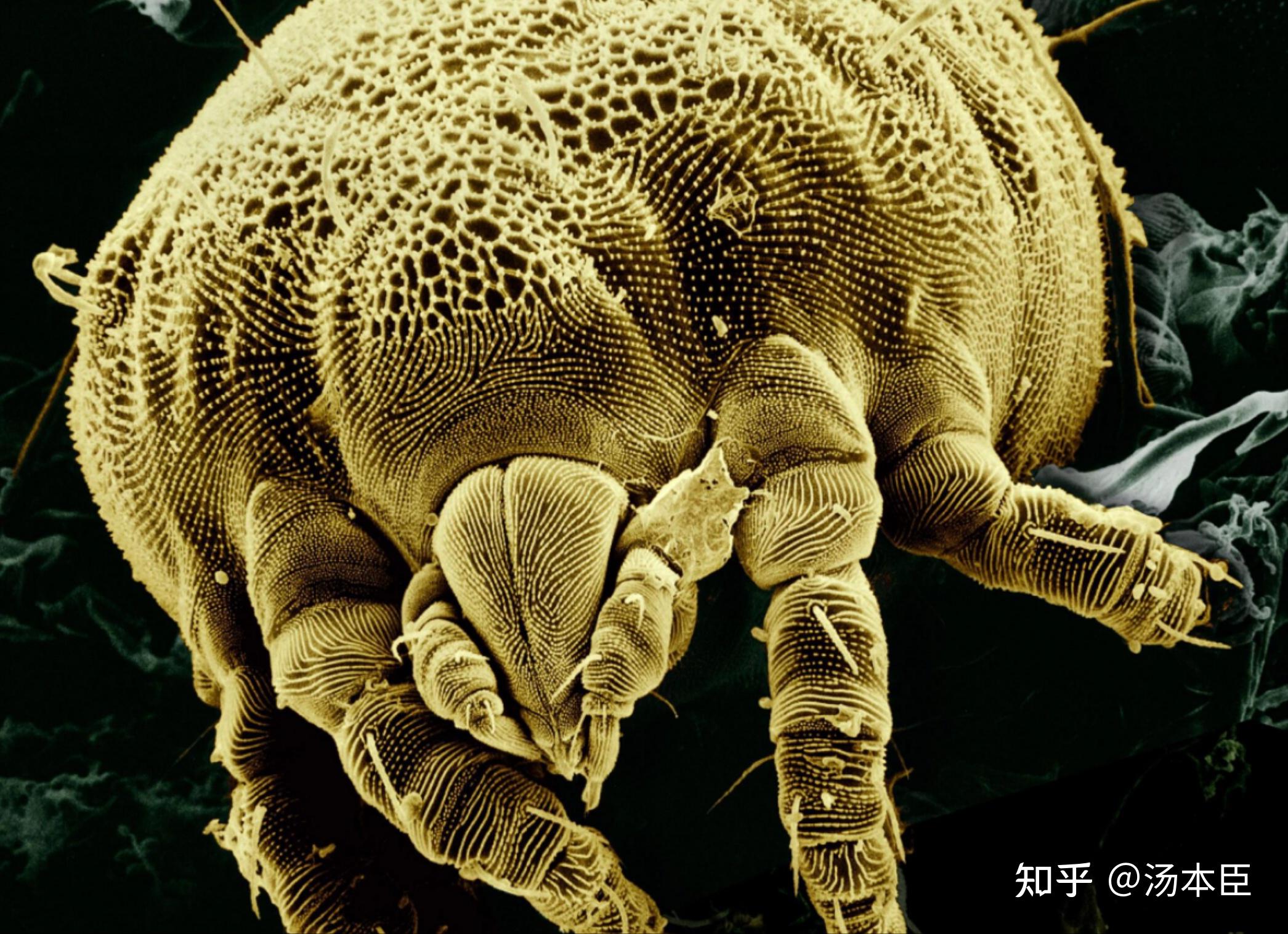 可恶的"螨虫脸"