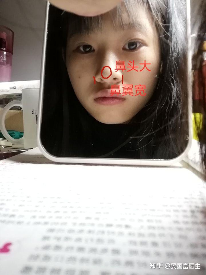 这是鼻子塌还是山根低呢