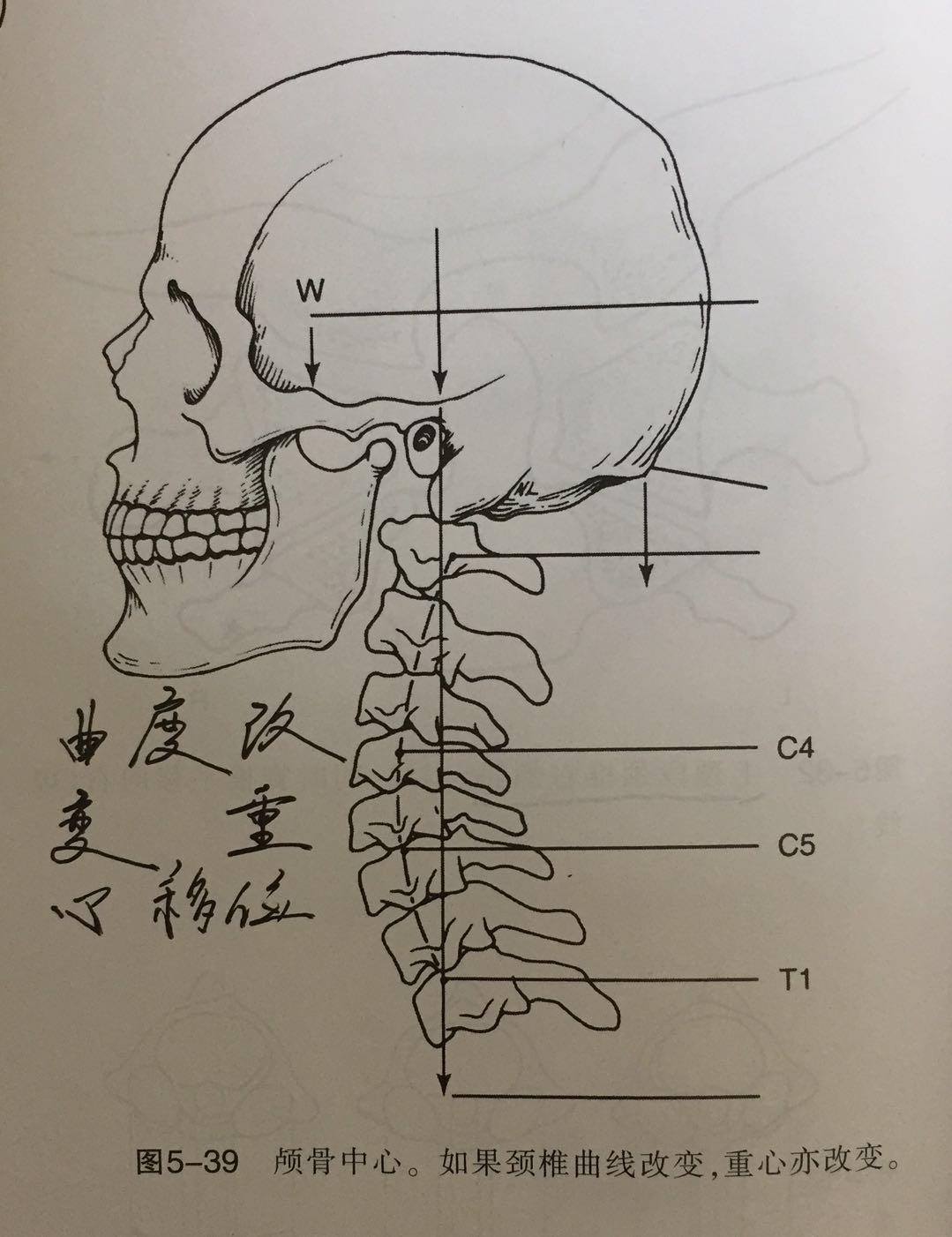 颈椎咔嚓响断了