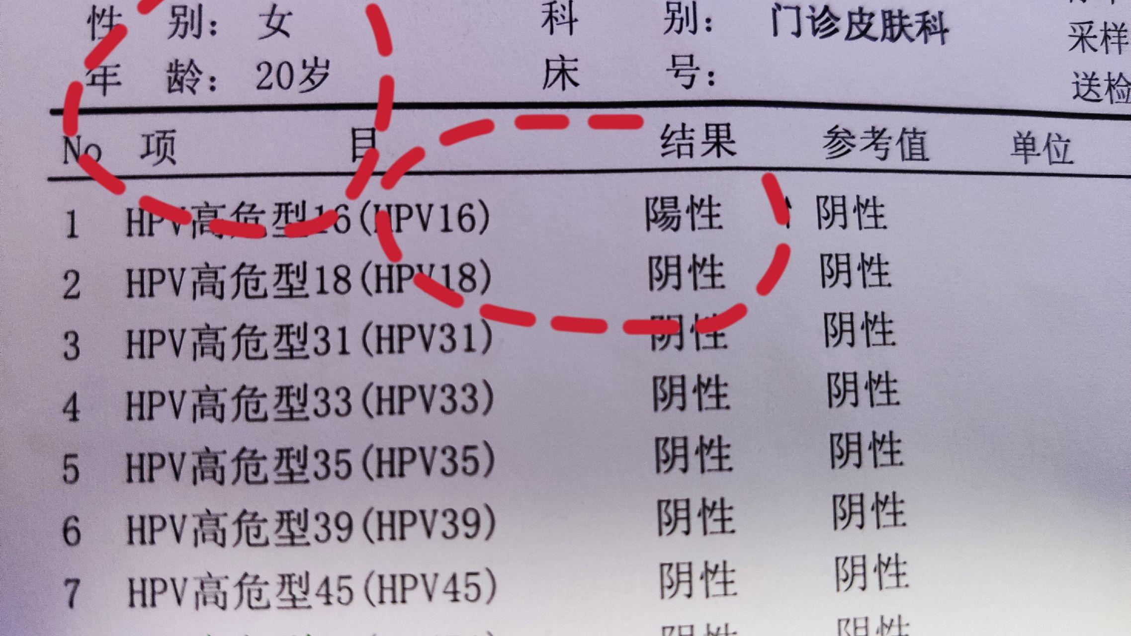 被查出来hpv16型阳性,担心?