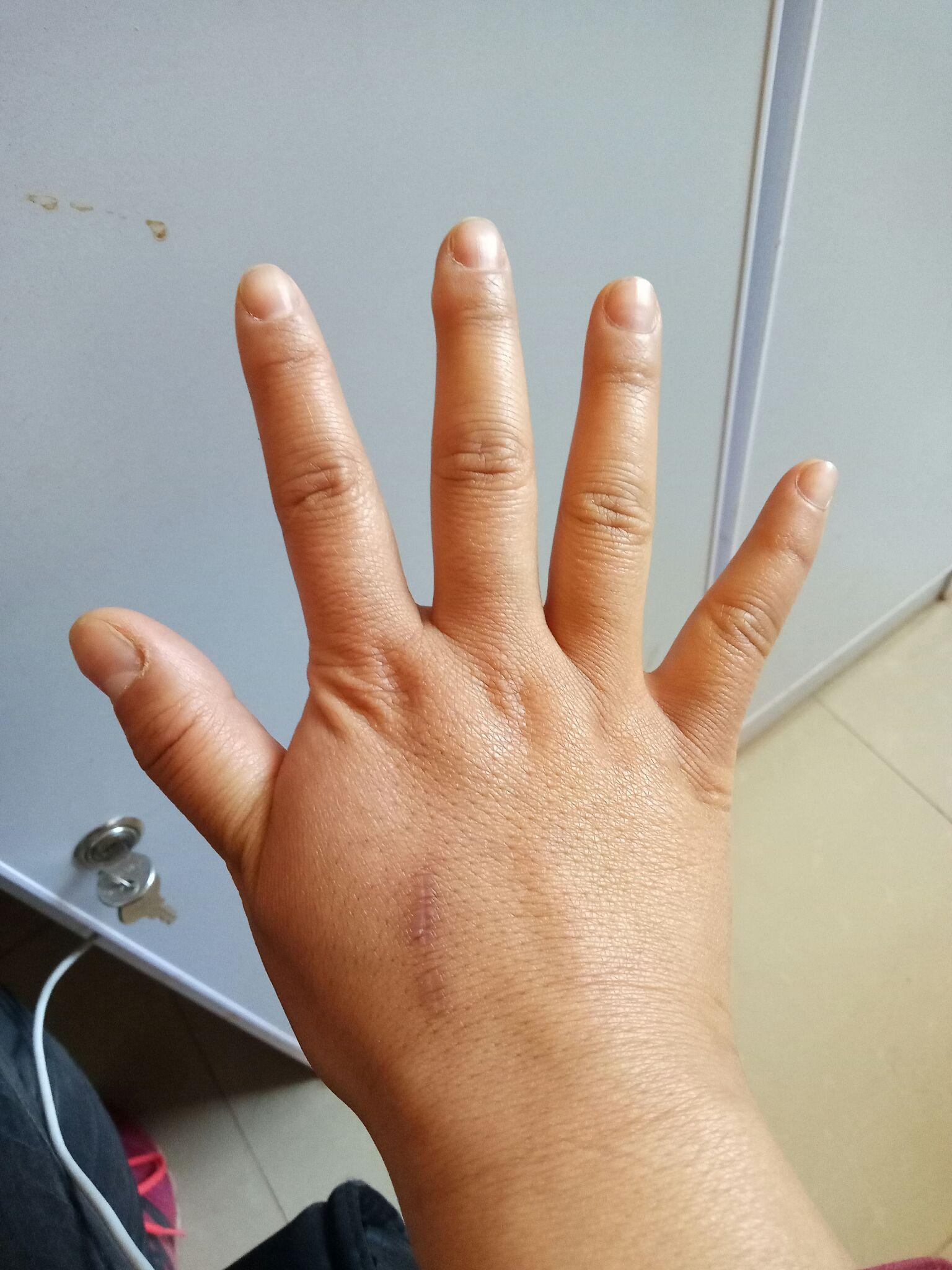 手小或者手胖或者手丑是一种什么体验