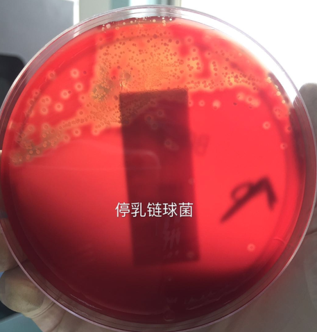 跟着教科书去认识细菌之链球菌属 - 知乎