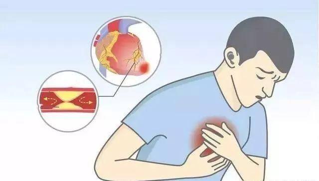 什么是生活方式疾病 v2-a507ece2ef582fe606623e60b8e2063f_1440w.jpg?source=172ae18b