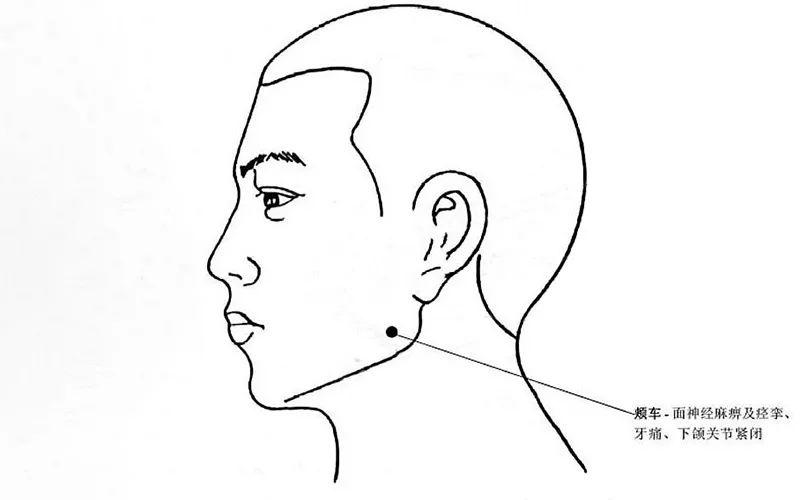 relieve toothache颊车穴缓解牙痛,牙髓炎,牙周炎01人体解锁