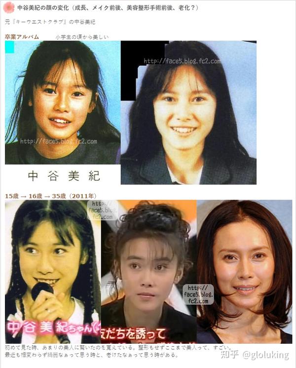 日本女明星童年长成整容大合集 知乎