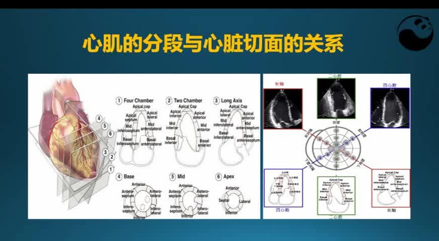 左心室分段图解图片