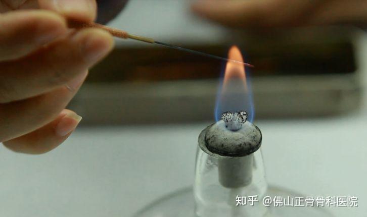 特色针灸疗法快进快出的火针疗法速治疼痛寒疾