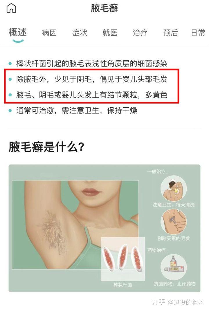 我剃了之后连续涂联苯卡唑软膏两个星期现在长起来的腋毛还是有白色固