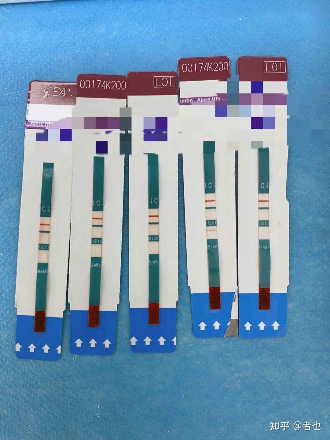 在圈子里无tao染艾很容易,10个感染hiv案例 - 知乎