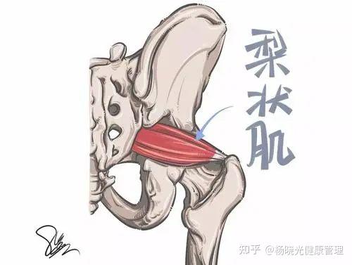 详尽剖析坐骨神经痛真凶不止它一个