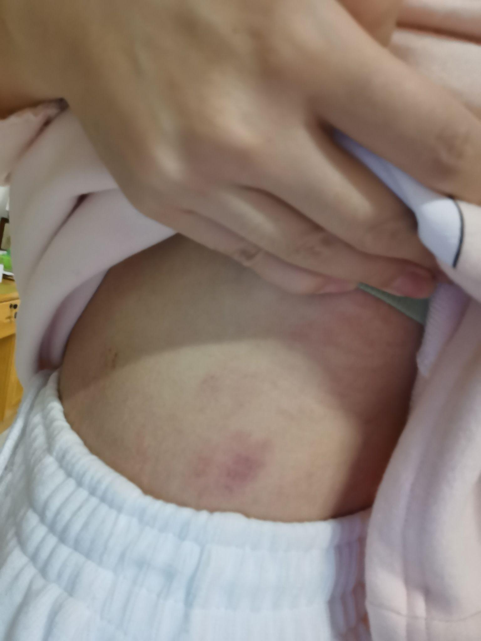 言情小说里的女主日常一身吻痕,身体不会有问题吗?