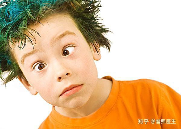 眼睛有显著表现,如先天性愚型的新生儿,两眼向外上方斜,内眼眦褶明显