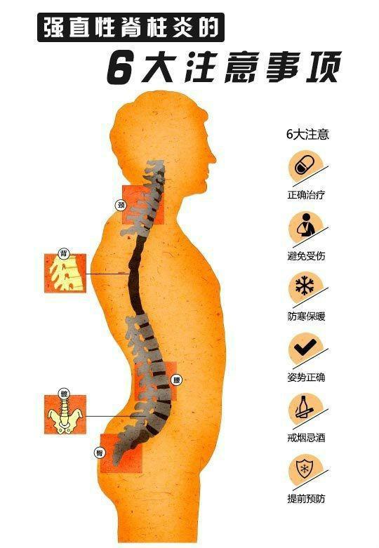 如何确诊强直性脊柱炎 知乎 如何确诊强直性脊柱炎 知乎