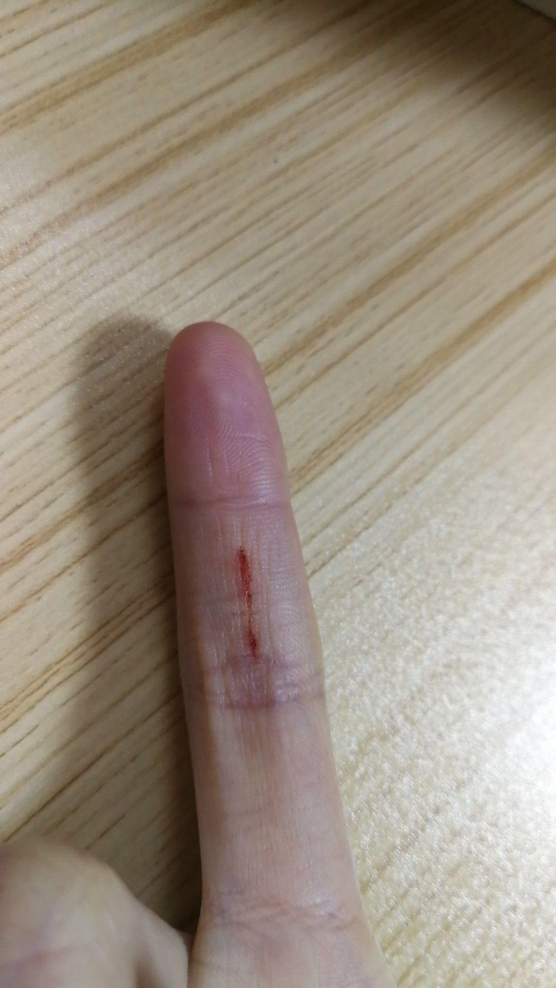 被自己家的猫抓了特别深的口子出血挺多的
