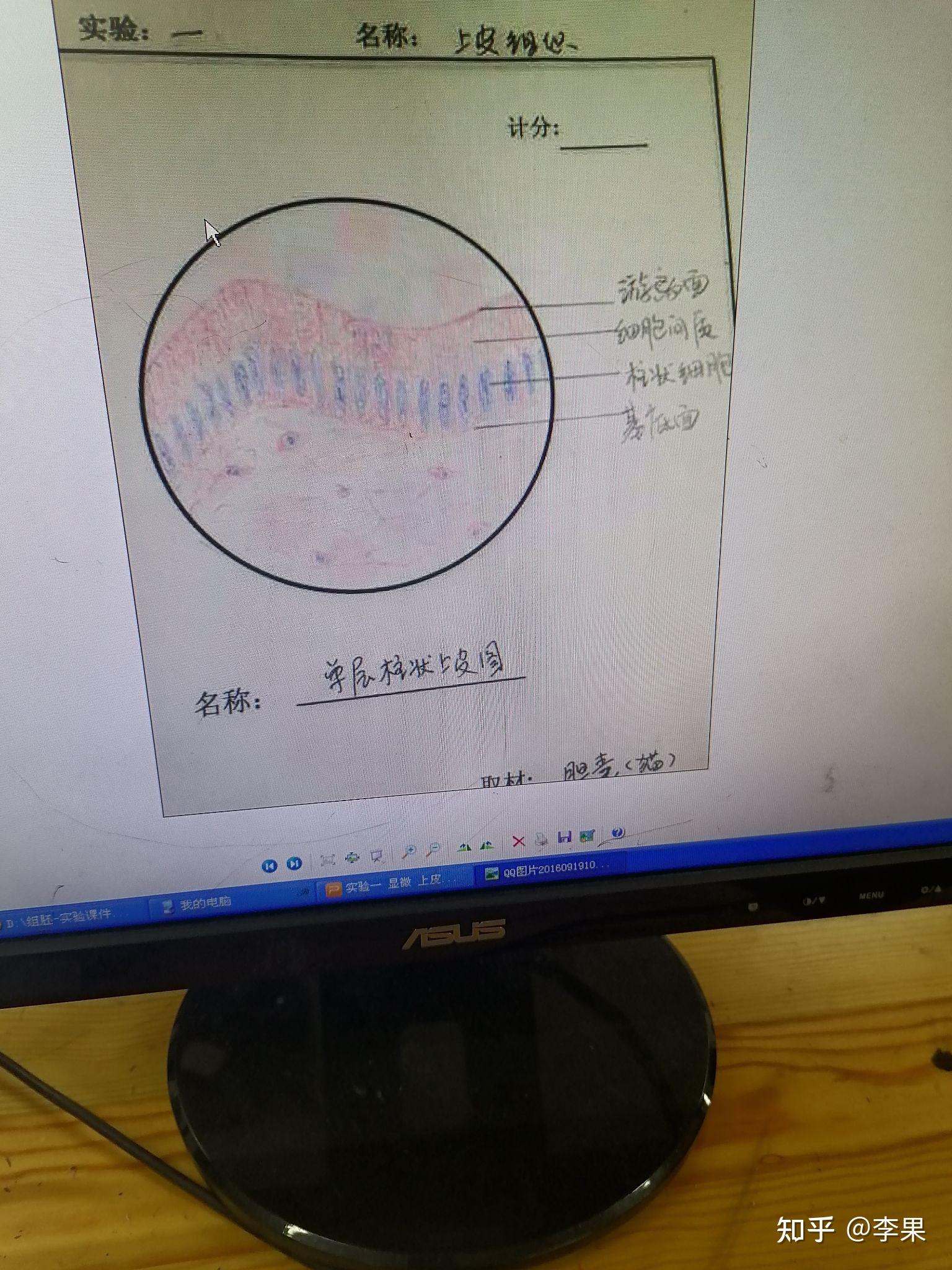 單層柱狀上皮細胞紅藍鉛筆怎麼畫呀? - 知乎